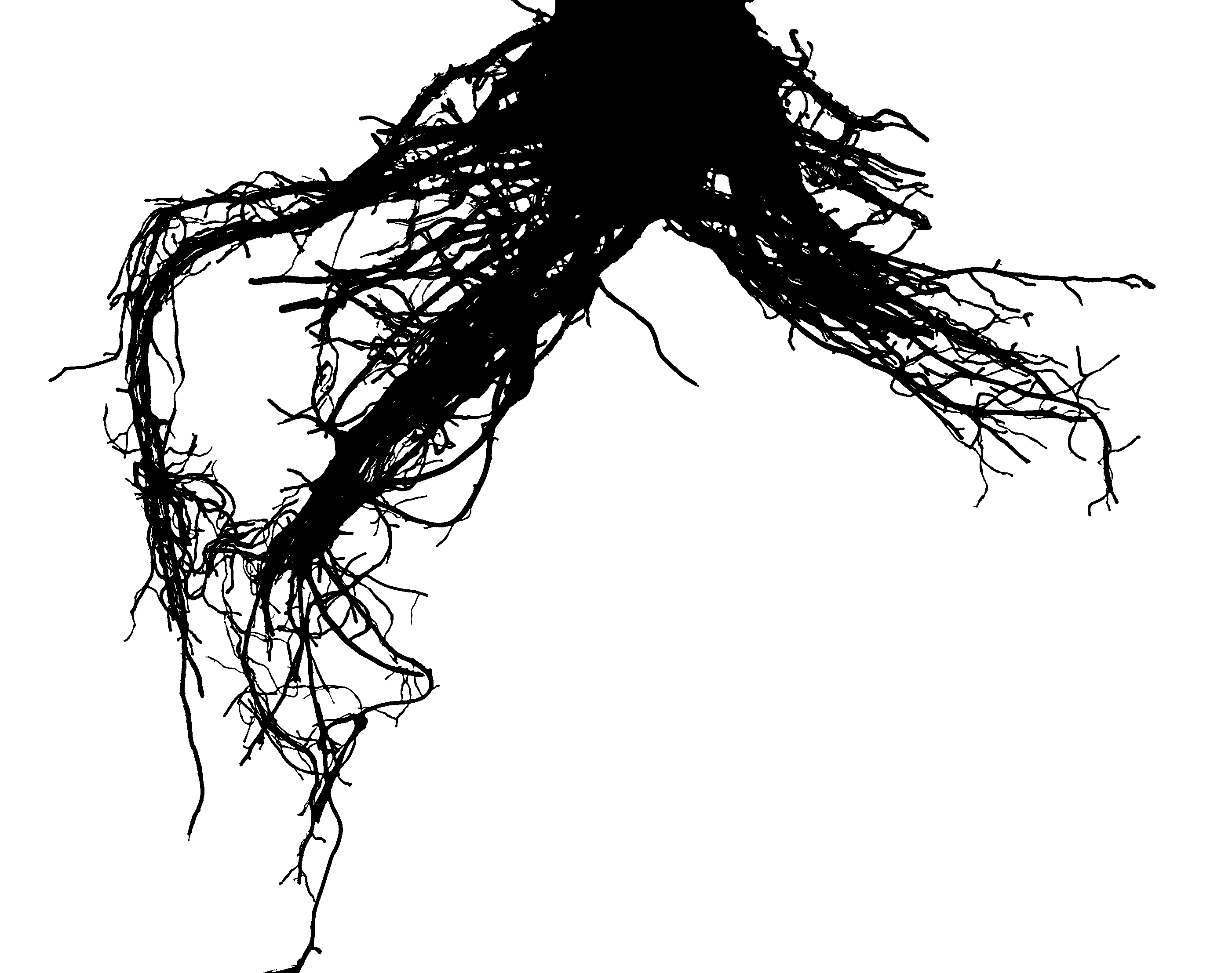 Picture of digital root scan